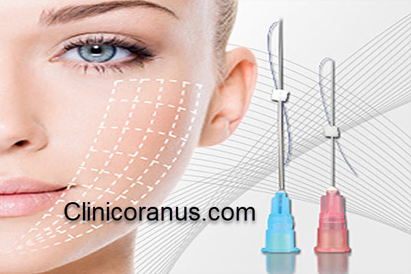 لیفت صورت با نخ چقدر ماندگاری دارد؟ | کلینیک اورانوس