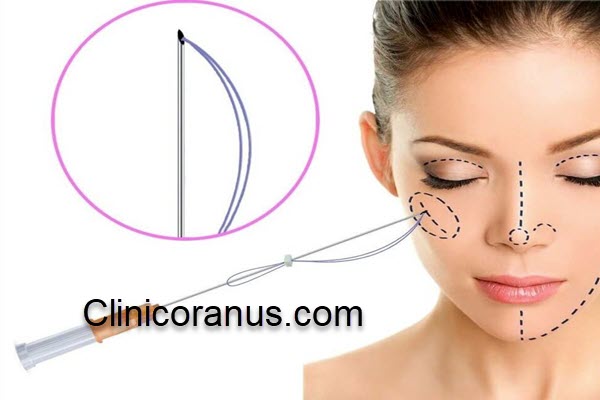 کلینیک تخصصی لیفت و جوانسازی صورت در جنت آباد | کلینیک اورانوس