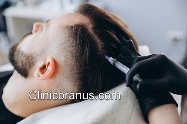 مزوتراپی مو چند جلسه است؟ | کلینیک اورانوس