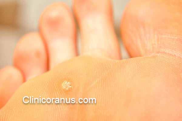 مشکلات پوستی ناشی از آب استخر | کلینیک اورانوس