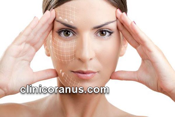 لیفت صورت با نخ در غرب تهران | کلینیک اورانوس