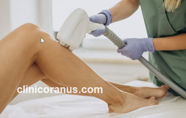 فواید پماد زینک اکساید بعد از لیزر موهای زائد | کلینیک اورانوس