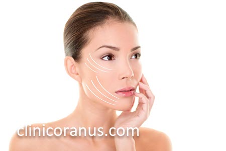 مرکز تخصصی لیفت صورت با نخ در غرب تهران | کلینیک اورانوس