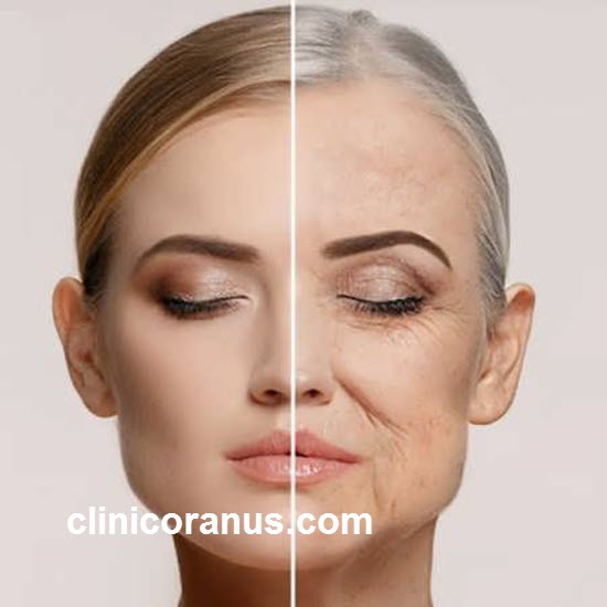 مزایای استفاده از بهترین روش لیفتینگ صورت بدون جراحی | کلینیک اورانوس