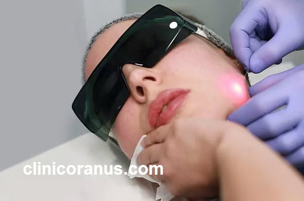 مراقبت ها و دستورالعمل های بعد از اندولیفت صورت | کلینیک اورانوس