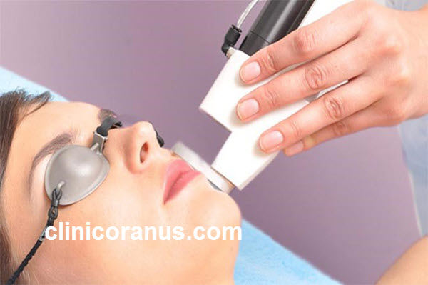 مراقبت های قبل و بعد از لیزر موهای زائد | کلینیک اورانوس