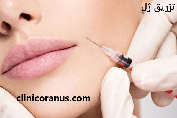 تزریق ژل با قیمتی بسیار مناسب در تهران - کلینیک اورانوس