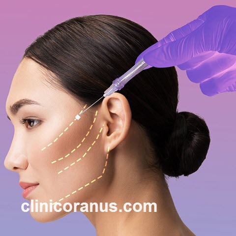 بررسی هزینه لیفت صورت با نخ سیلوئت | کلینیک اورانوس