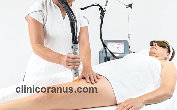 قیمت هر جلسه لیزر موهای زائد چقدر است؟ | کلینیک اورانوس