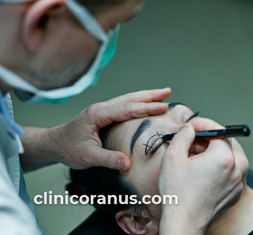 کاندیدای مناسب برای انجام عمل بلفاروپلاستی | کلینیک اورانوس