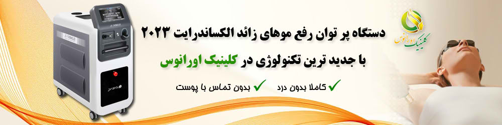 جدیدترین دستگاه لیزر موهای زائد | کلینیک اورانوس