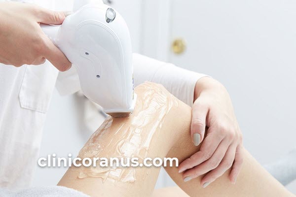 بهترین کلینیک لیزر موهای زائد با دستگاه الکساندرایت | کلینیک اورانوس