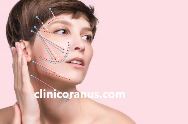 هزینه لیفت صورت با نخ سیلوئت | کلینیک اورانوس