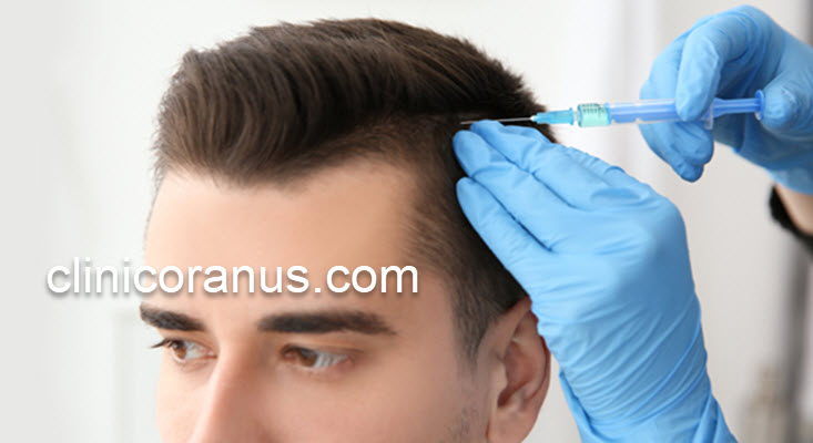 مزوتراپی مو با ماندگاری بالا | کلینیک اورانوس