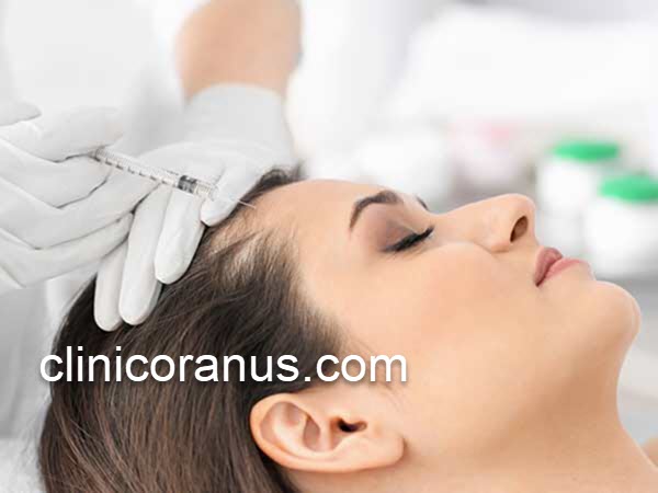 مدت ماندگاری مزوتراپی مو | کلینیک اورانوس