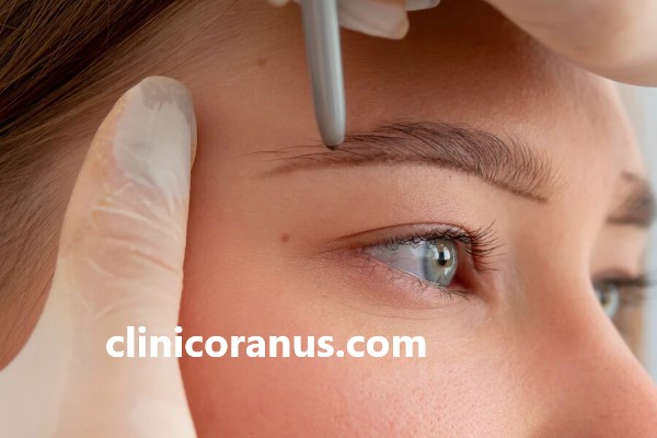 کاشت ابرو به روش FUT با هزینه کم | کلینیک اورانوس