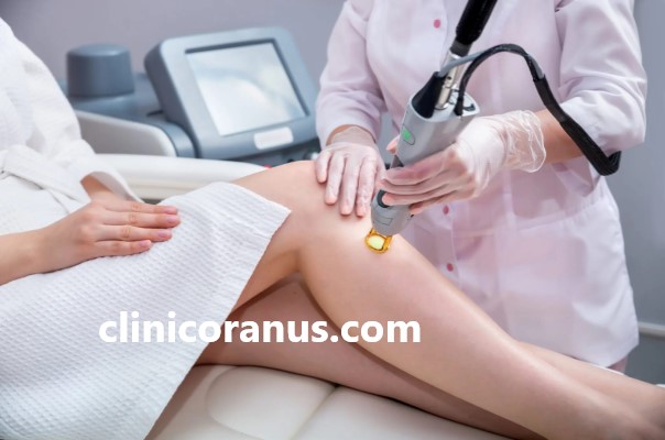 مزایای لیزر مو بدن با دستگاه الکساندرایت | کلینیک اورانوس