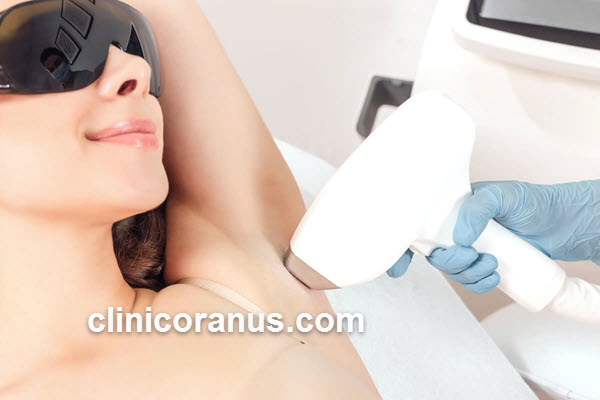 جدیدترین دستگاه لیزر موهای زائد بدون درد | کلینیک اورانوس