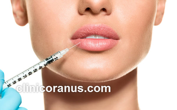 مهم ترین نکات مراقبتی پس از تزریق فیلر لب | کلینیک اورانوس