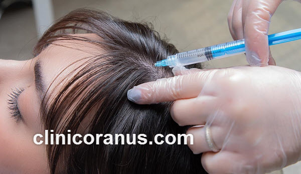 درمان ریزش مو با مزوتراپی | کلینیک اورانوس