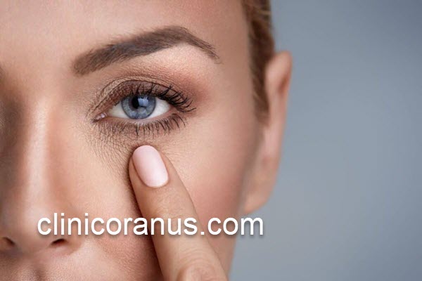 تأثیرات عالی مزوتراپی زیر چشم | کلینیک اورانوس