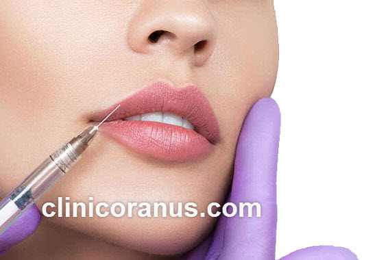 مراقبت های بعد از فیلر لب | کلینیک اورانوس