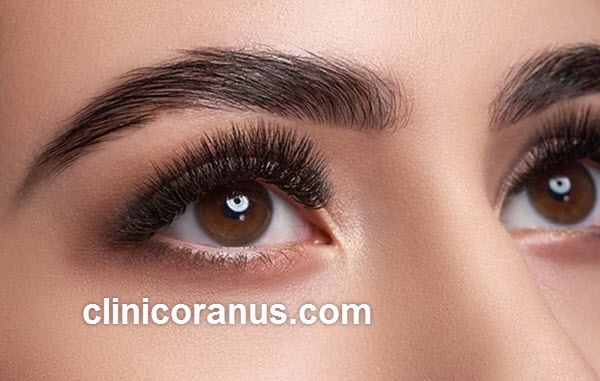 هزینه کاشت ابرو طبیعی در کلینیک اورانوس