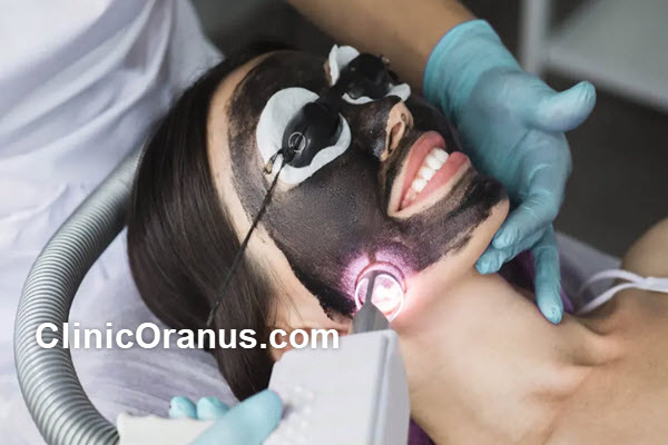 لیزر کیوسوئیچ مدلایت چیست؟ | کلینیک اورانوس