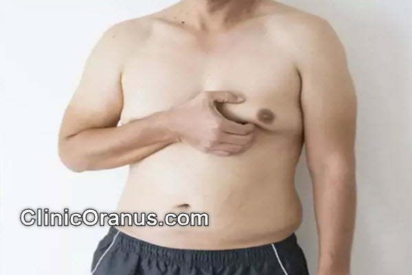 مراقبتهای بعد از عمل ژنیکوماستی در کلینیک اورانوس | کلینیک اورانوس