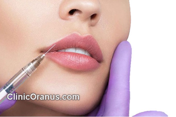 مهمترین مراقبتهای بعد از فیلر لب | کلینیک اورانوس