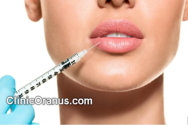 بهترین کلینیک تزریق فیلر لب در جنت آباد | کلینیک اورانوس