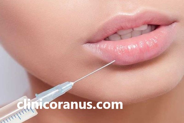 بهترین دکتر تزریق ژل لب در غرب تهران | کلینیک اورانوس