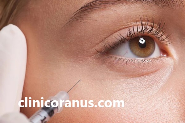 انجام مراقبت های پس از تزریق فیلر زیر چشم | کلینیک اورانوس