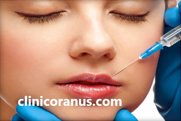 تزریق فیلر لب طبیعی | کلینیک اورانوس