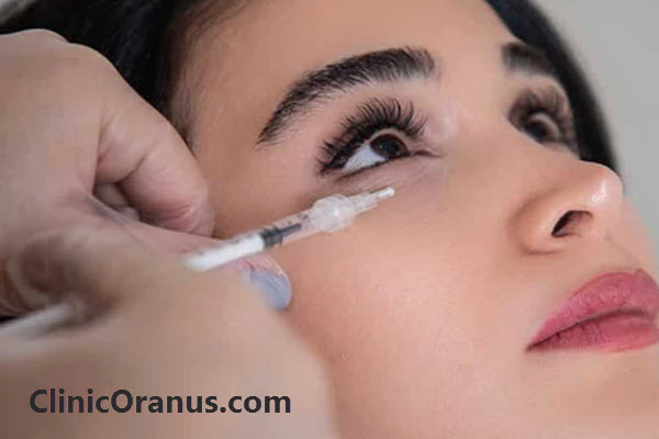 مزوژل چشم چیست؟