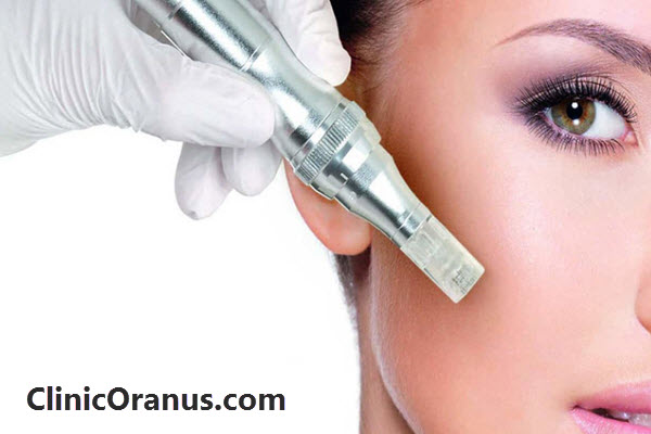 بهترین مرکز میکرونیدلینگ در جنت آباد
