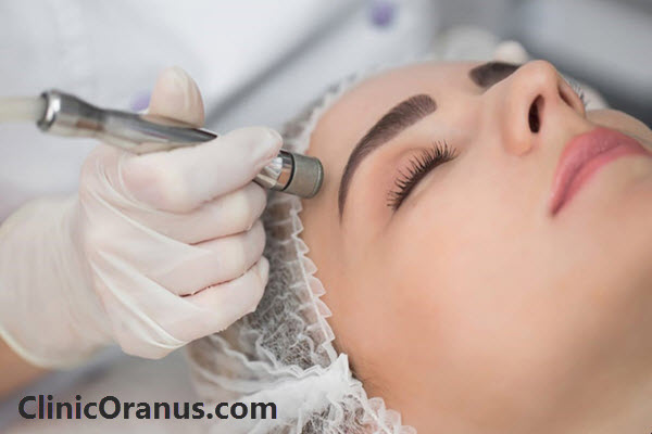 روش های میکرودرم ابریژن