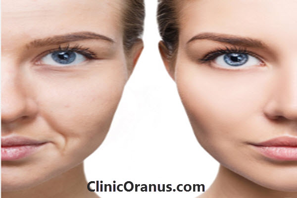 مزوژل جالپرو چیست؟ | کلینیک اورانوس
