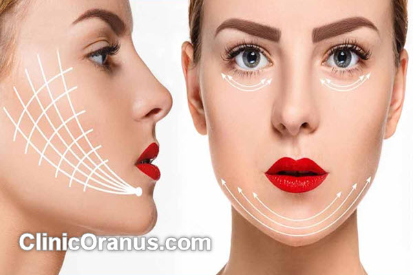 بهترین دکتر زاویه سازی صورت در غرب تهران | کلینیک اورانوس