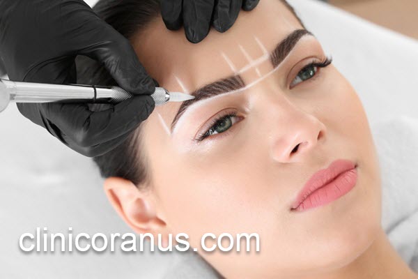 هزینه های کاشت ابرو طبیعی | کلینیک اورانوس