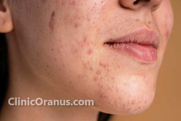 بیماری پوستی چیست؟ | غرب تهران