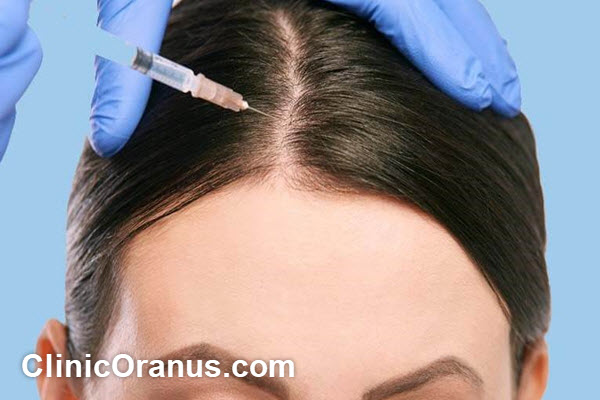 عوامل مؤثر بر تعداد جلسات مزوتراپی مو | کلینیک اورانوس