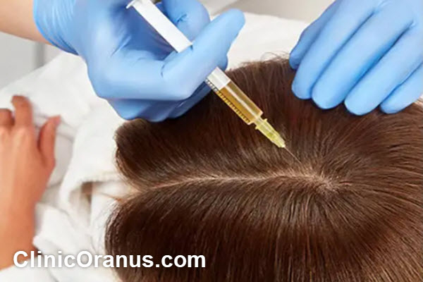 مزوتراپی مو چیست و چگونه عمل می کند؟ | کلینیک اورانوس