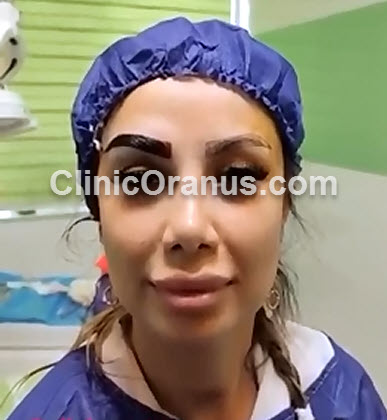 حین-انجام-کاشت-ابرو-کلینیک-اورانوس بهترین مرکز کاشت ابرو | کلینیک اورانوس