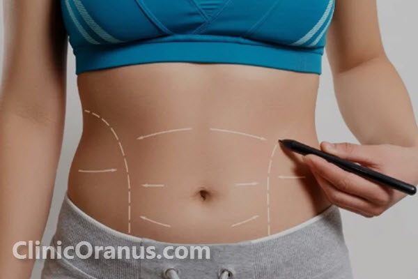 مزایای لیپوماتیک کدامند؟