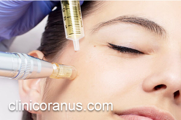 بررسی قیمت جلسات مزوتراپی صورت | کلینیک اورانوس