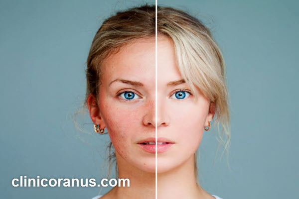 شناسایی و طبقه بندی اسکارها | کلینیک اورانوس