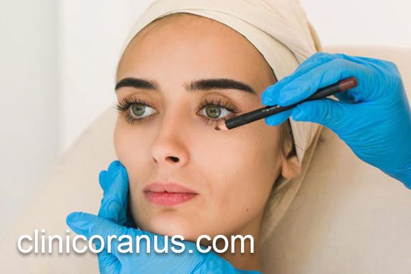 هزینه جراحی پلک پایین در تهران | کلینیک اورانوس