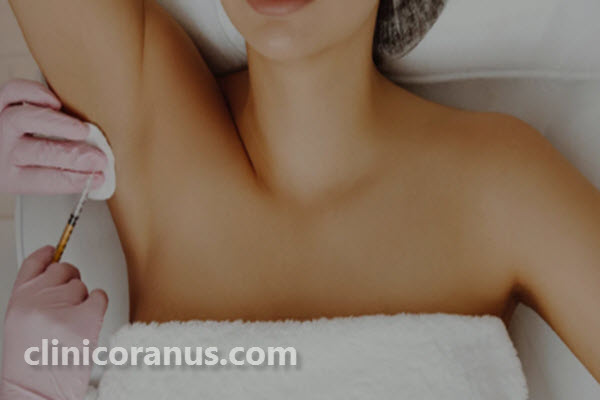 بوتاکس زیر بغل چیست؟