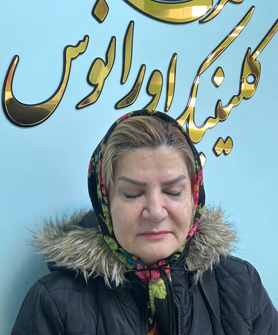 رضایت-از-نتیجه-بلفاروپلاستی-در-کلینیک-اورانوس فیلم رضایت از نتیجه بلفاروپلاستی | کلینیک اورانوس